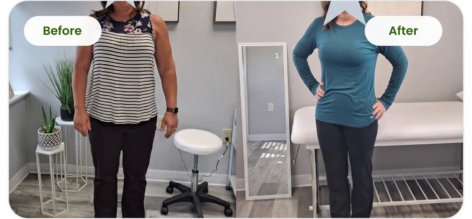 Patient before and after medical weight loss, standing front view